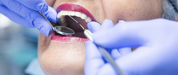 Best Emergency Dental Care for Broken or Chipped Teeth in Lovelock, NV